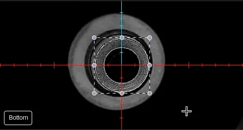 毫米/像素校准 毫米/像素校准